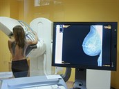 Olomoucká fakultní nemocnice představila nový moderní mamograf, který je v... Olomoucká fakultní nemocnice představila nový moderní mamograf, který je v...