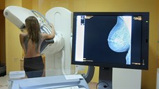 Olomoucká fakultní nemocnice představila nový moderní mamograf, který je v... Olomoucká fakultní nemocnice představila nový moderní mamograf, který je v...