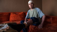 Michal Koleno z Orlové, který přežil srpnové důlní neštěstí s těžkými... Michal Koleno z Orlové, který přežil srpnové důlní neštěstí s těžkými...