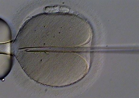 Umlé oplodnní lidského vajíka injekcí spermie. Nejde o bnou souást...