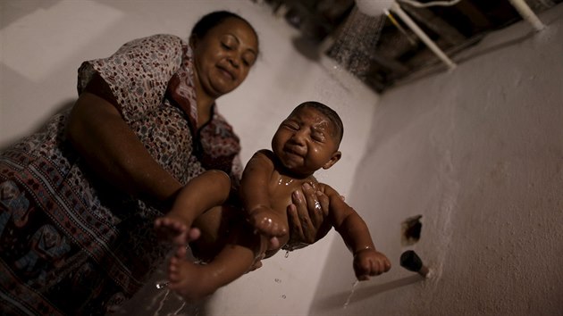 Od roku 2015 bylo v Brazlii zaznamenno 3893 ppad mikrocefalie u novorozenc.