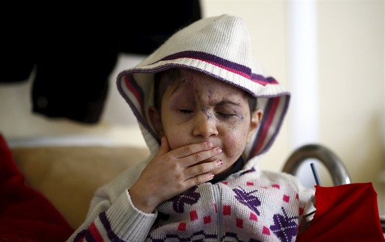 Ptiletá ejma ztratila zrak, kdy ji v Sýrii zasáhla zbloudilá kulka. Nyní je...