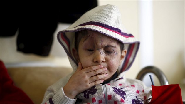 Ptiletá ejma ztratila zrak, kdy ji v Sýrii zasáhla zbloudilá kulka. Nyní je...