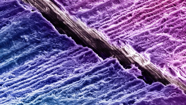 Snmek z elektronovho mikroskopu ukazuje prasklinu v zubu.