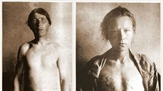 Kastráti z ruské sekty Skopců na nedatované fotografii Kastráti z ruské sekty Skopců na nedatované fotografii
