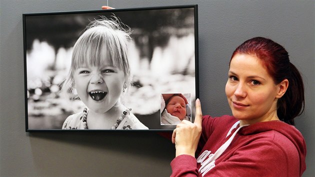 Vstava fotografi dt narozench s roztpovou vadou v oblieji je k vidn ve vestibulu pavilonu A nemocnice v Karlovch Varech.