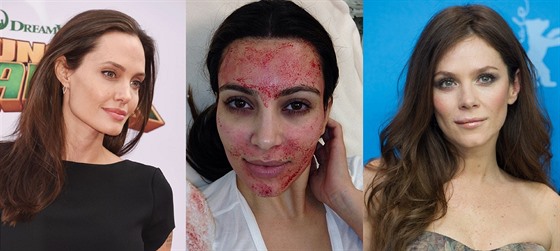 Oetení krevní plazmou zkusily Angelina Jolie, Kim Kardashianová i Anna...