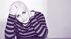 Chemoterapie mě brzy připravily o vlasy. Chemoterapie mě brzy připravily o vlasy.