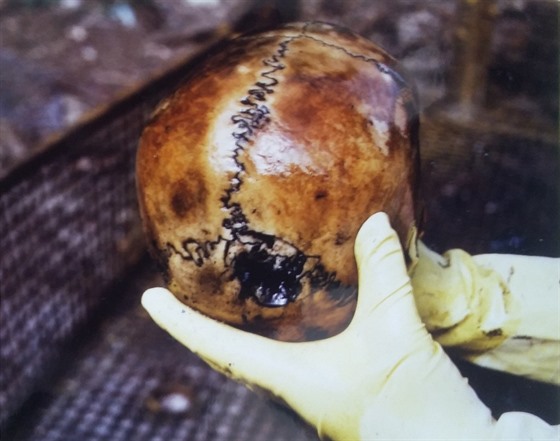 Ostatky lidských kostí a obleení nalezené v roce 2005 v septiku na Litomicku.