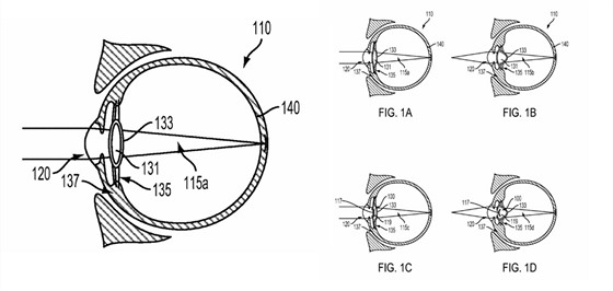 Nákres z patentu Googlu na zaízení umístné do oka, které má zlepit jeho...