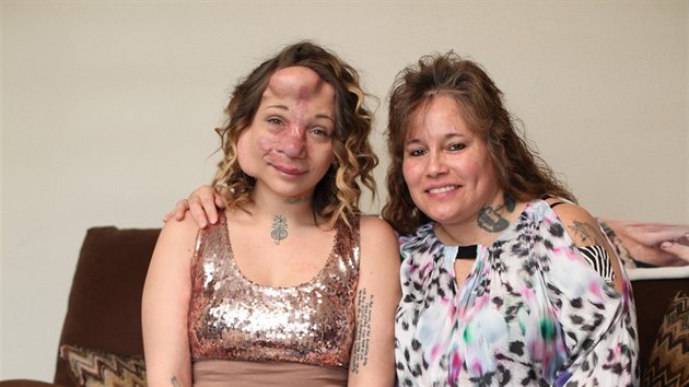 Jennifer Hilesov s maminkou, kter to v ivot tak nem jednoduch. Kvli nehod pila o nohu.