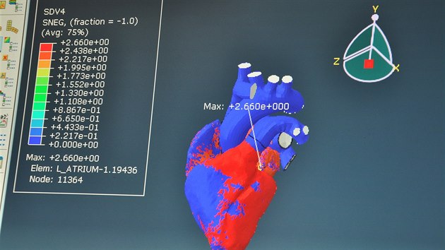 Barvy znzoruj pohyby srdce, elektrick stimuly i stahy sval.