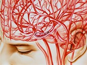 Mozková mrtvice - ilustrační fotografie Mozková mrtvice - ilustrační fotografie