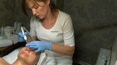 Ošetření pleti kyslíkem Ošetření pleti kyslíkem