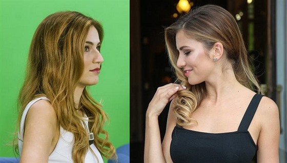 eská Miss 2016 Andrea Bezdková ped plastikou nosu (vlevo) a po zákroku...