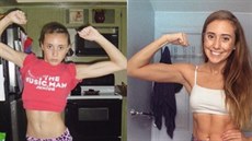 Sarah Francati v době, kdy přestávala jíst a dnes Sarah Francati v době, kdy přestávala jíst a dnes