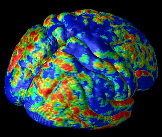 3D snímek lidského mozku získaný magnetickou rezonancí (ilustraní snímek)