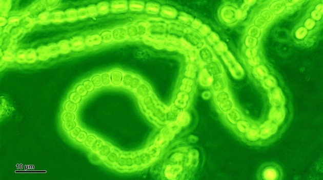 Sinice (Cyanobacteria). Vyznačují se schopností fotosyntézy, při níž vzniká... Sinice (Cyanobacteria). Vyznačují se schopností fotosyntézy, při níž vzniká...
