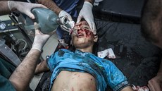 Dítě zraněné při vládní náletech na Aleppo čeká na ošetření v jedné z místních... Dítě zraněné při vládní náletech na Aleppo čeká na ošetření v jedné z místních...