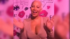 Amber Rose zvauje zmenení prsou. Obává se ale pooperaních jizev.