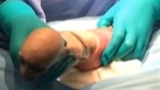 Operace proběhla bez komplikací, vlastní "narození" mláděte trvalo zhruba... Operace proběhla bez komplikací, vlastní "narození" mláděte trvalo zhruba...