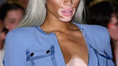 Výrazné edé ombré modelky Winnie Harlow