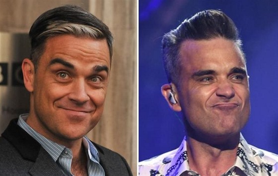 Robbie Williams propadl kouzlu plastik a kosmetických zákrok