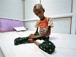 Osmnctilet Jemenka trp extrmn podvivou. (25. jna 2016)