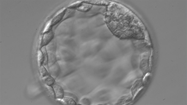 Takto by mlo vypadat embryo pt den po oplozen.
