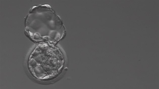 Embryo opoutjc obal ped implantac. Embryo se mus uvolnit z obalu (spontnn hatching), kter ho chrnil v prvnch dnech vvoje, aby mohlo dojt k tsnmu kontaktu mezi embryem a dlohou. Pot nsleduje pijet embrya v dloze - uhnzdn. Embryo pumpuje tekutinu mezi buky, vytvo dutinku, kter se zvtuje, embryo se rozpn, obal se ztenuje a praskne. Pot takto vzniklm otvorem embryo vycestuje z obalu a me bt transportovno do dlohy, dodv doktorka Ladislava Jelnkov ze Sanatoria PRONATAL.