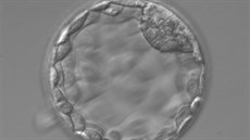 Takto by mlo vypadat embryo pátý den po oplození.