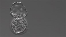 Embryo opoutjící obal ped implantací. Embryo se musí uvolnit z obalu...