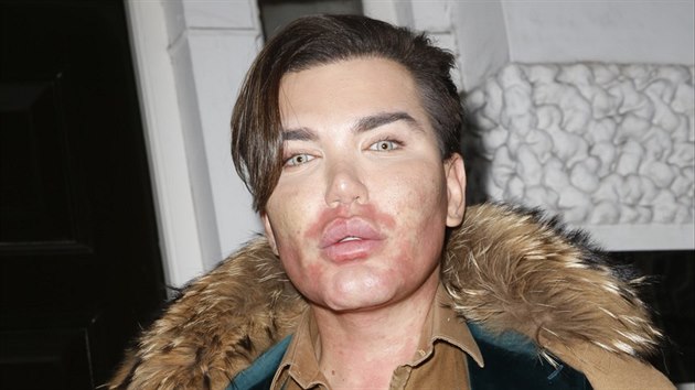 Rodrigo Alves (2016)