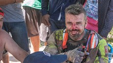 Potluený Luká Kvapil poté, co pro nj Rallye Dakar 2017.skonila.