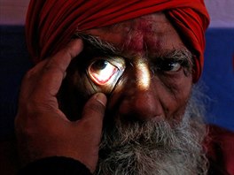 ONÍ VYETENÍ. Hinduistický mu podstupuje vyetení zraku v kempu bezplatné...