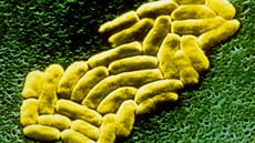 Nadbytené uívání antibiotik vede k váným problémm s rezistentními bakteriemi, které na ádná antibiotika nereagují.