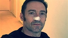 Hugh Jackman opt bojuje s rakovinou ke (2017).