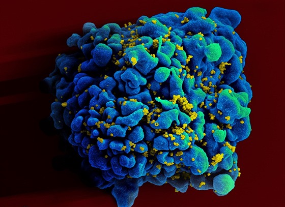 Virem HIV nakaená buka imunitního systému