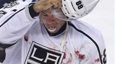 Jarome Iginla po pěstním souboji s Derykem Engellandem v zápase mezi Los... Jarome Iginla po pěstním souboji s Derykem Engellandem v zápase mezi Los...