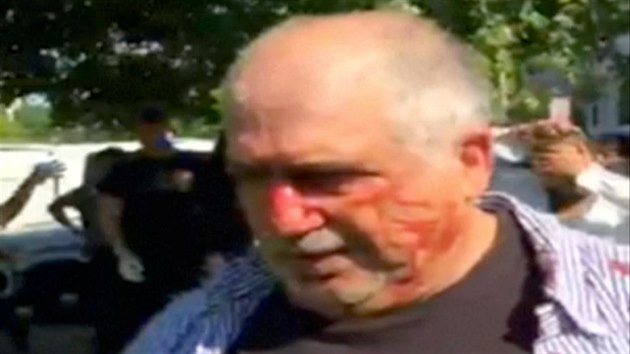 Jeden z lid zrannch pi bitce u rezidence tureckho velvyslance ve Washingtonu (16. kvtna 2017)