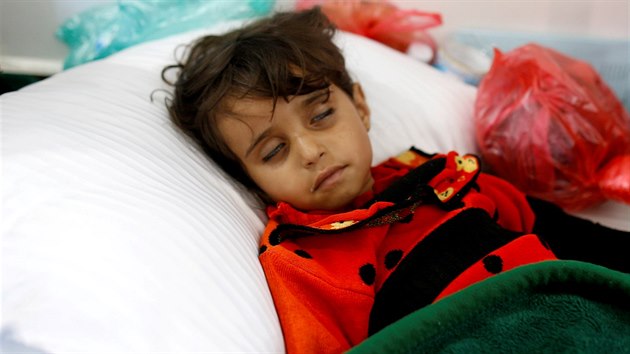 V Jemenu se  cholera, zdravotnickch zazen v zemi je vak kvli vlce nedostatek. Nejvt nebezpe hroz tem milionm podvyivench dt (7. kvtna 2017).