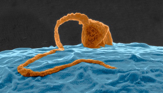 Lidská spermie oplodující vajíko. Ilustraní foto