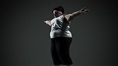 Následky obezity jsem velké. Snižte riziko nemocí tím, že zhubnete Následky obezity jsem velké. Snižte riziko nemocí tím, že zhubnete