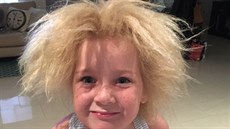 Za rošťácký účes australské školačky může genetická porucha. Za rošťácký účes australské školačky může genetická porucha.
