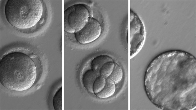 Chronologická sekvence vývoje geneticky upravených lidských embryí z dílny týmu... Chronologická sekvence vývoje geneticky upravených lidských embryí z dílny týmu...