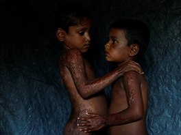 Rohintí uprchlíci pózují pro fotografa v bangladéském uprchlickém táboe...