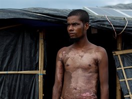 Rohinský uprchlík pózuje pro fotografa v bangladéském uprchlickém táboe...