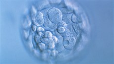 Blastocysta - jedna z embryonálních fází při vývoji savců. Blastocysta - jedna z embryonálních fází při vývoji savců.