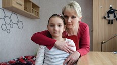 Karlička se narodila s obličejových rozštěpem. Lékaři ji defekt odstranili už... Karlička se narodila s obličejových rozštěpem. Lékaři ji defekt odstranili už...