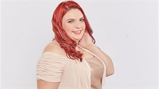 Kateřina trpí vzácnou kožní chorobou zvanou hidradenitida. Kateřina trpí vzácnou kožní chorobou zvanou hidradenitida.